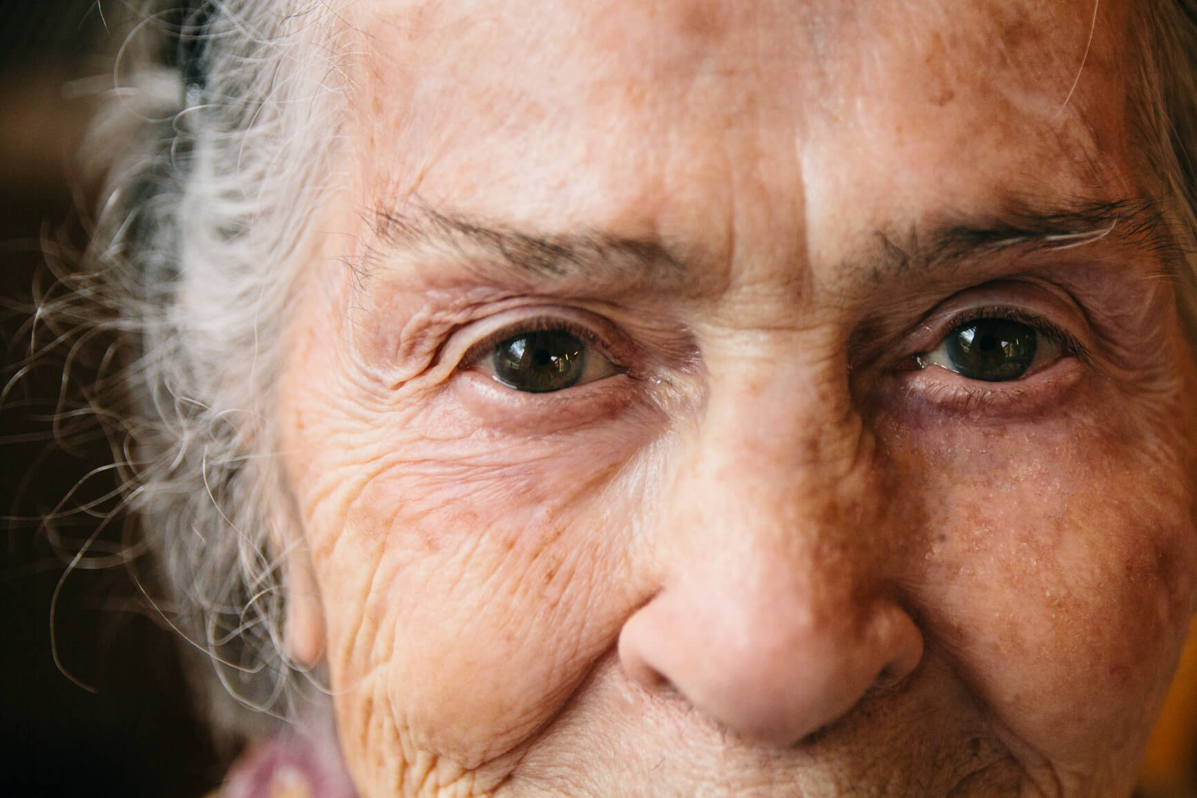 The incidence of cataracts increases with age