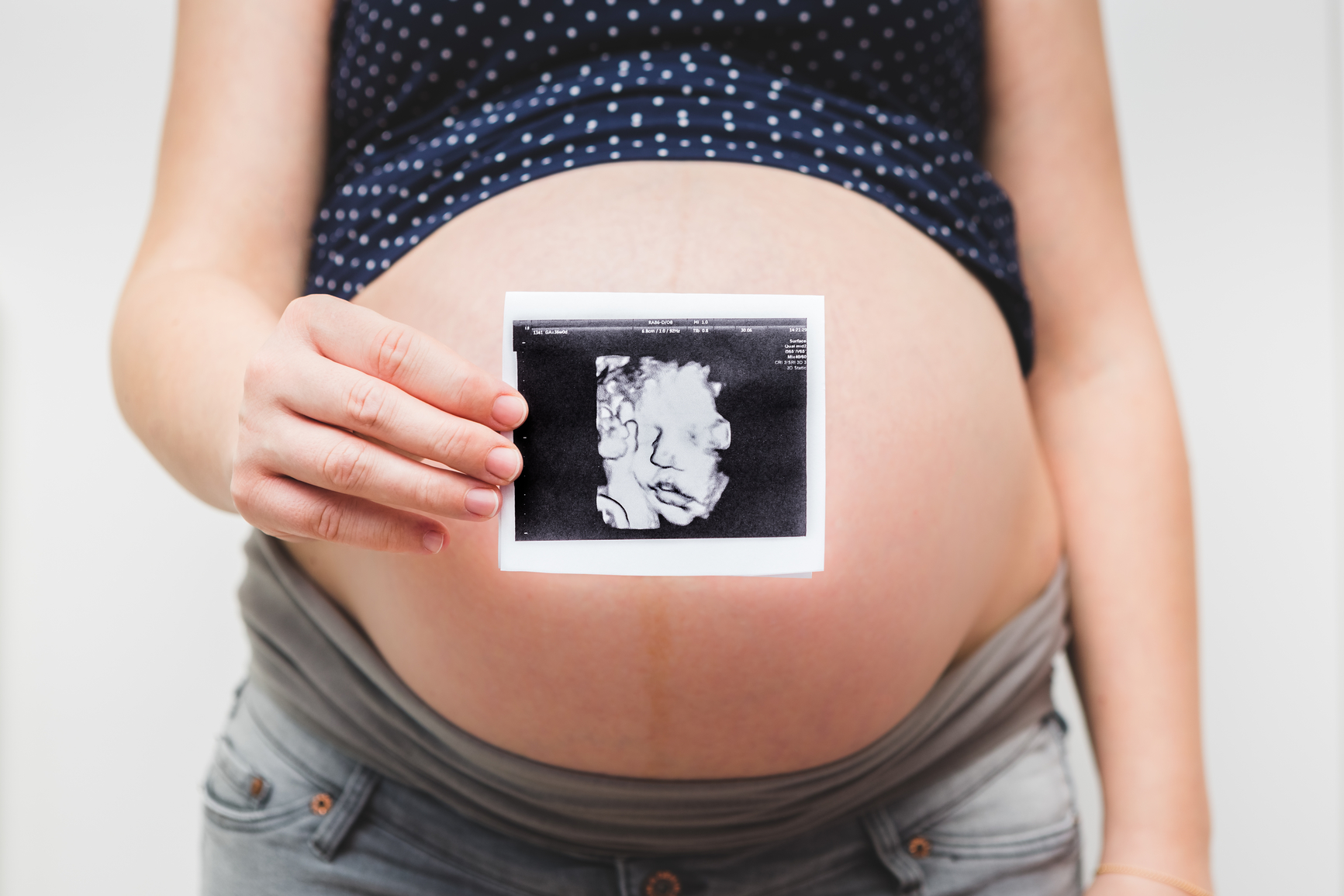 Pregnant woman holding echography of her baby.