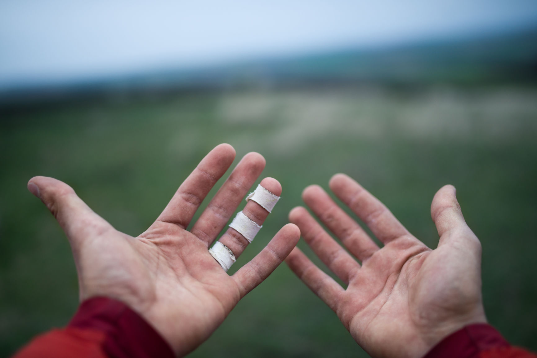 close up of Caucasian male rock climber palms with finger injury