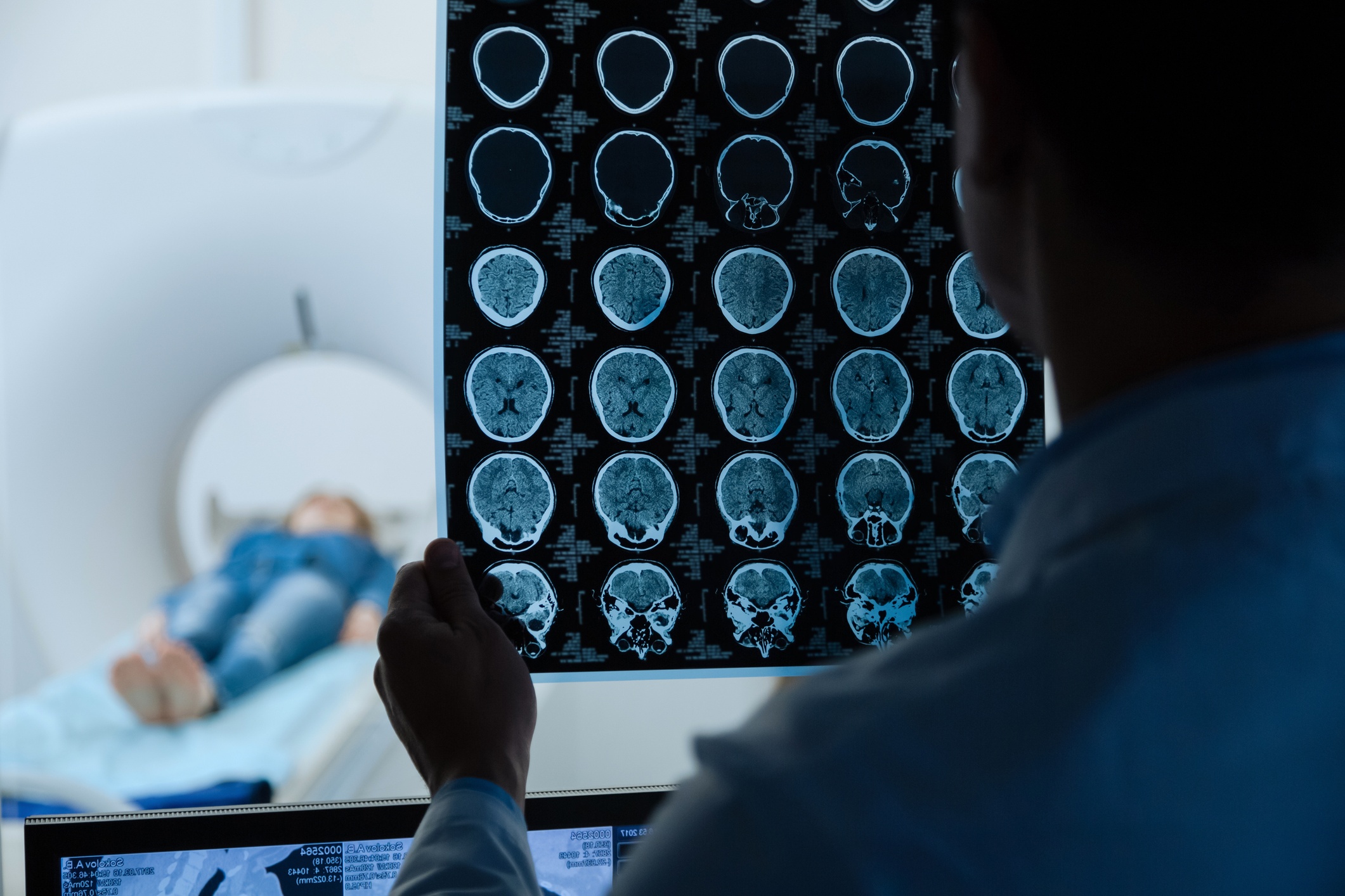 Brain pathology. Close up of MRI scan images being examined by a professional male doctor while doing a medical research